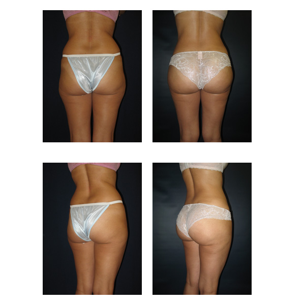 Jennifer lopez nackt fake picture 805