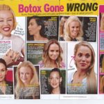 Botox Gone Wrong In Touch Sept 2014