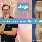 Normal Recovery Period After a Brazilian Butt Lift