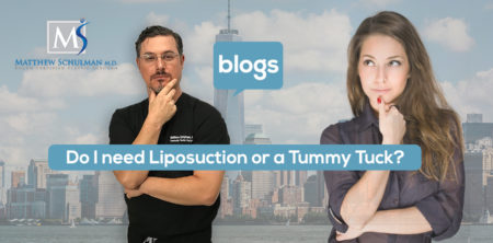 Do I need Liposuction or a Tummy Tuck?