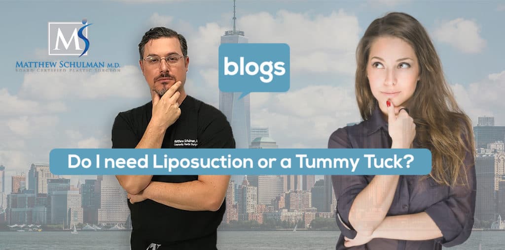 Do I need Liposuction or Tummy Tuck