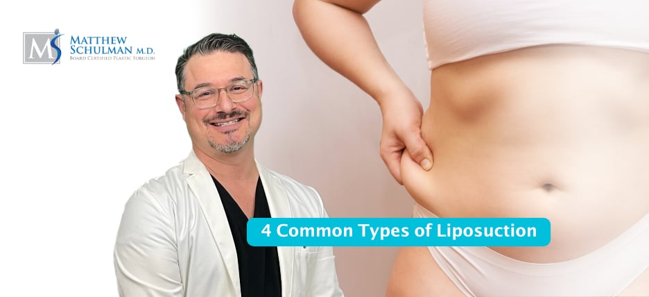 4 Common Types Of Liposuction