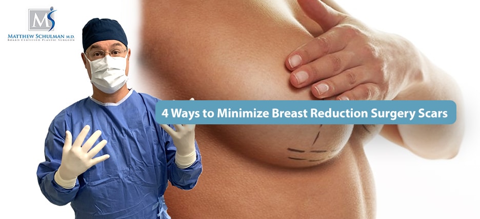 4 Ways to Minimize Breast Reduction Surgery Scars