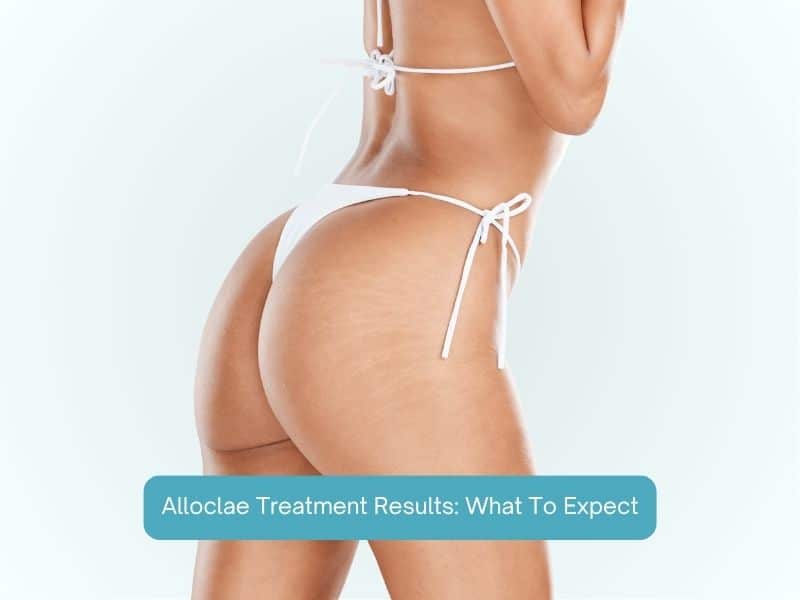 Alloclae Treatment Results- What To Expect