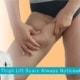 Are Thigh Lift Scars Always Noticeable
