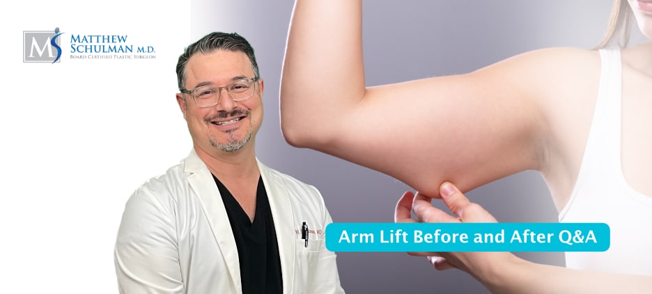 Arm Lift Before And After QA