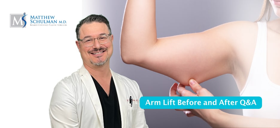 Arm Lift Before And After QA