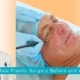 Assessing Male Plastic Surgery Before and After Photos