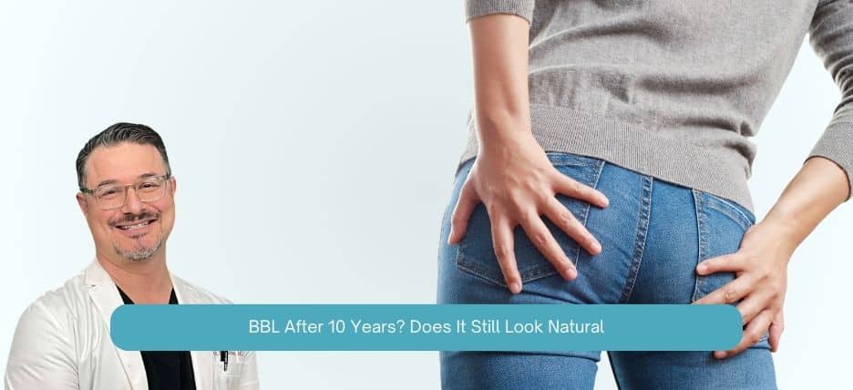 BBL After 10 Years Does It Still Look Natural