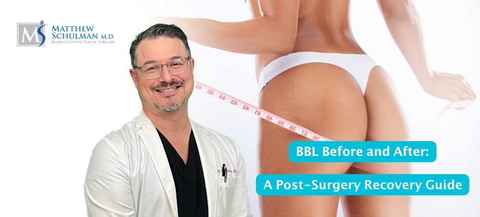 BBL Before And After A Post Surgery Recovery Guide