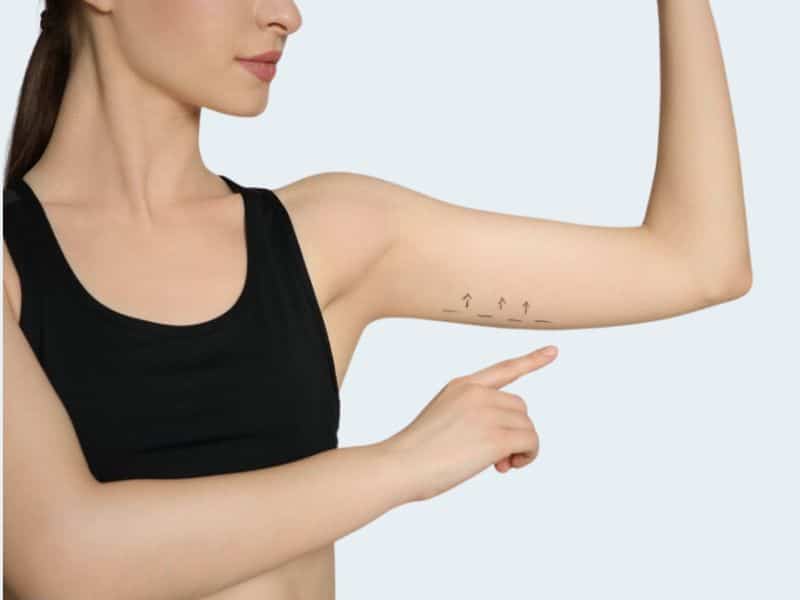 Best mini armlift