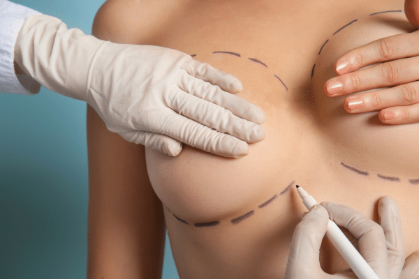 Breast Lift Incision Opening