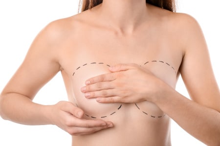 Breast Lift Results