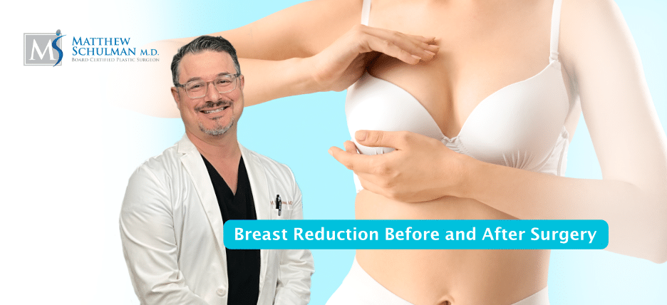 Breast Reduction Before And After Surgery