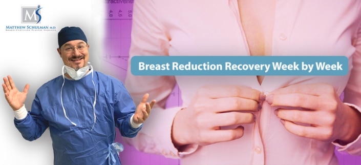 Breast Reduction Recovery Week by Week
