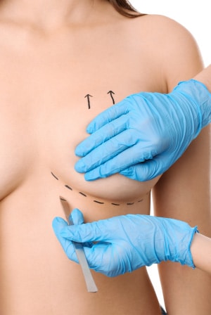 Breast lift meaning