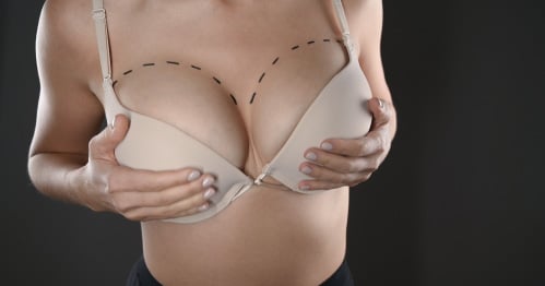 Breast reduction surgery scars