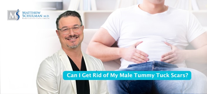 Can I Get Rid Of My Male Tummy Tuck Scars