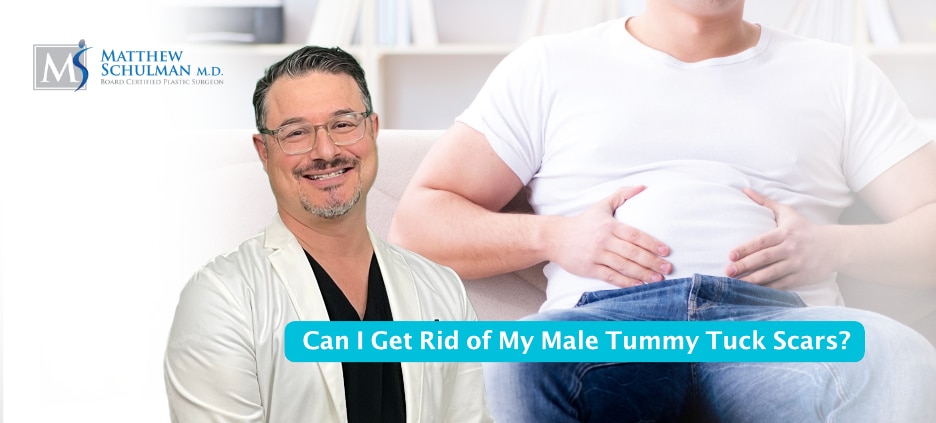 Can I Get Rid of My Male Tummy Tuck Scars