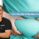 male tummy tuck scar