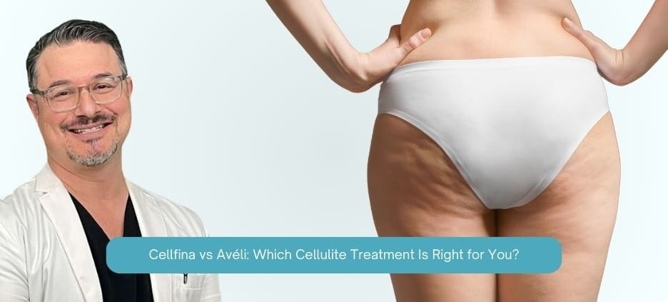 Cellfina vs Avéli Which Cellulite Treatment Is Right for You