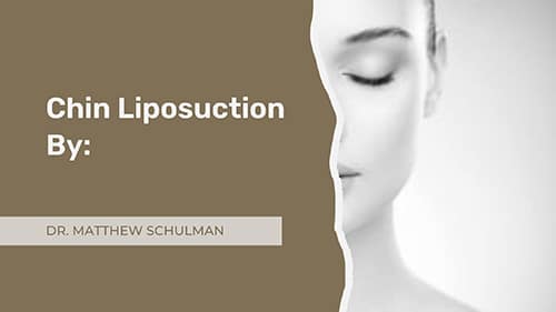 Chin Liposuction Botched