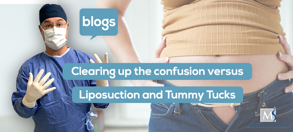 Clearing up the confusion versus Liposuction and Tummy Tucks