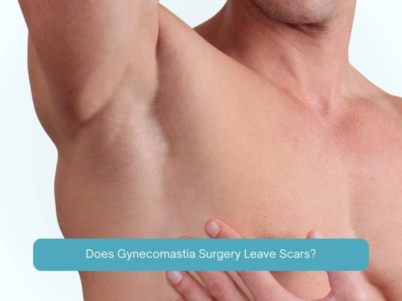 Does Gynecomastia Surgery Leave Scars