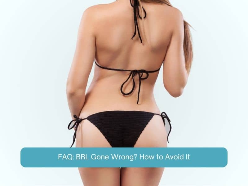 FAQ: BBL Gone Wrong_ How to Avoid It