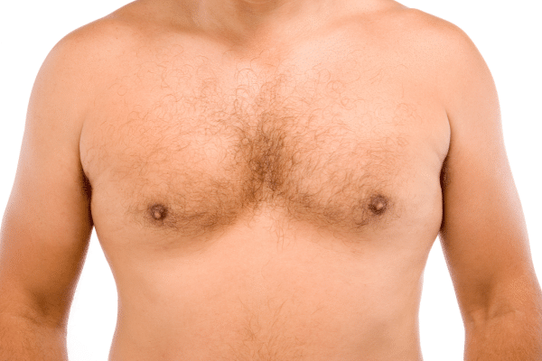 Gynecomastia Surgery