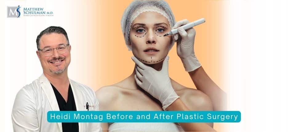Heidi Montag Before and After Plastic Surgery