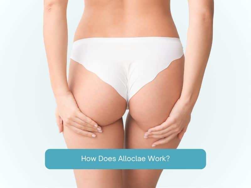 How Does Alloclae Work?