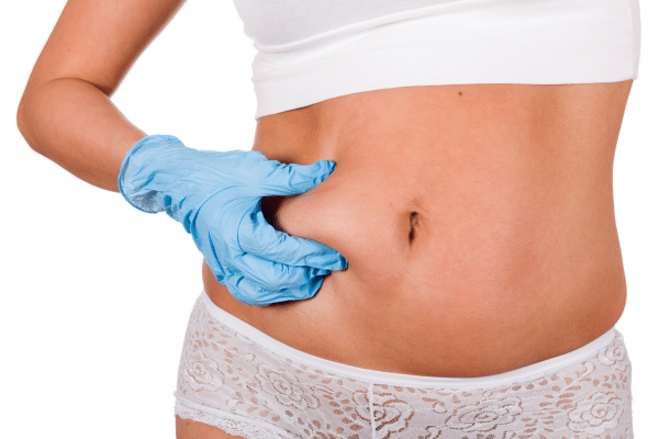 How Much Does Liposuction Cost