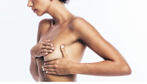 How do you know if you need a breast lift