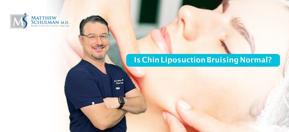 Is Chin Liposuction Bruising Normal