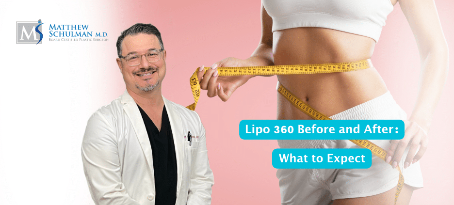 Lipo 360 Before And After What To Expect