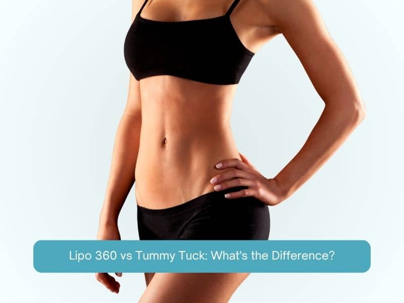 Lipo 360 vs Tummy Tuck - What's the Difference
