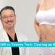 Liposuction 360 Vs Tummy Tuck Clearing Up The Confusion