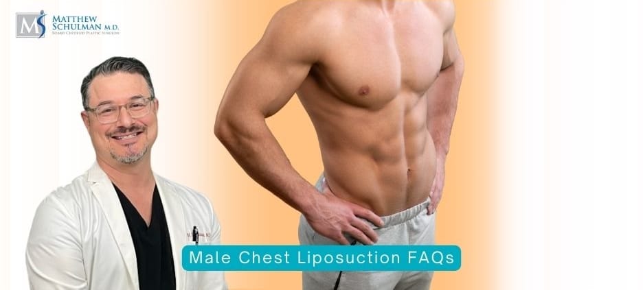 Male Chest Liposuction FAQs