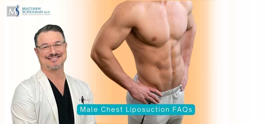 Male Chest Liposuction FAQs