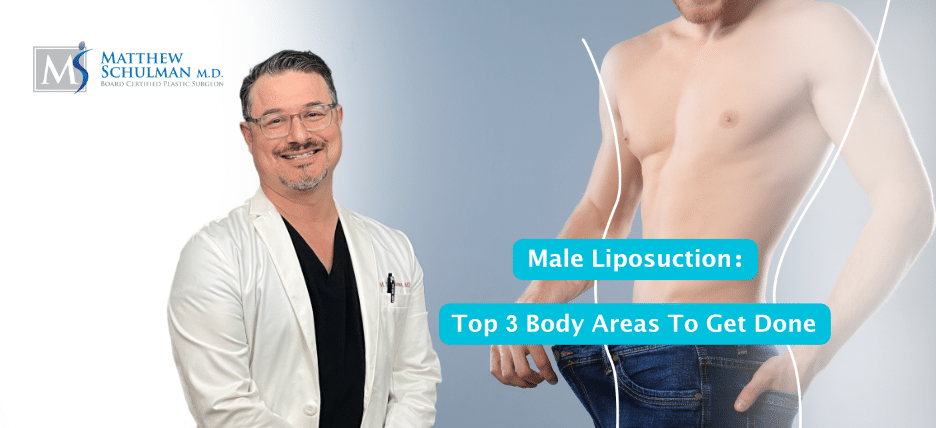 Male Liposuction Top 3 Body Areas To Get Done
