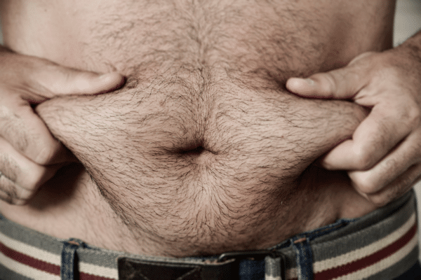 Male Scars After Liposuction