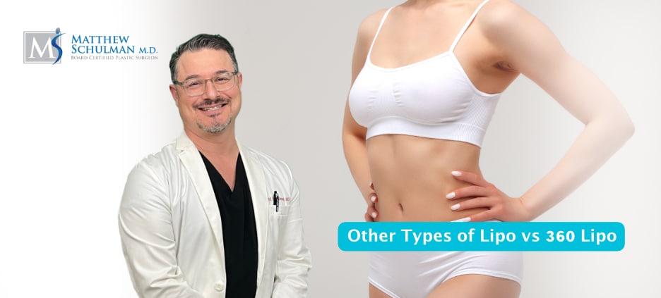 Other Types Of Lipo Vs 360 Lipo