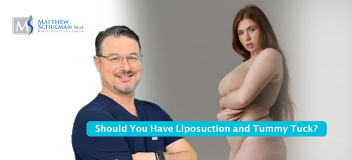 Should You Have Liposuction And Tummy Tuck