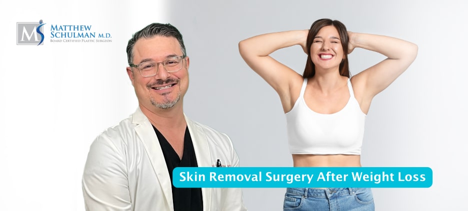 Skin Removal Surgery After Weight Loss