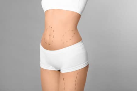 Smart lipo vs lipo