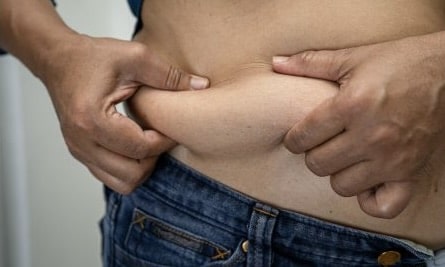 Tummy Tuck Male