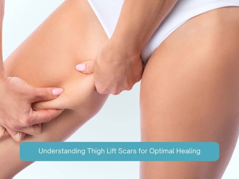 Understanding Thigh Lift Scars for Optimal Healing