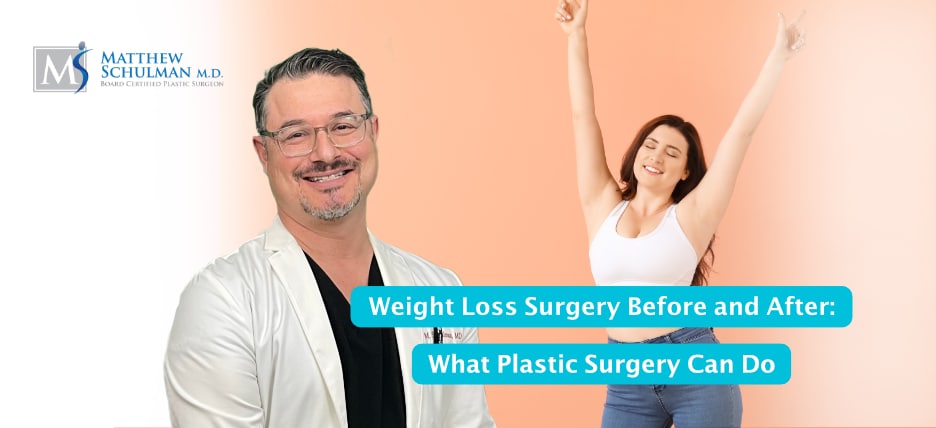 Weight Loss Surgery Before And After What Plastic Surgery Can Do