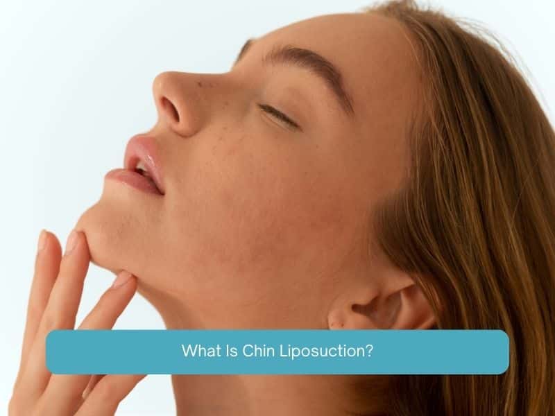 What Is Chin Liposuction